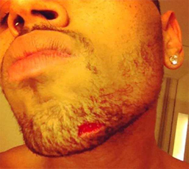 Altercation violente entre Chris Brown et Drake !