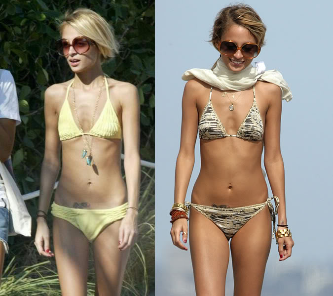 Nicole Richie : A nouveau anorexique?