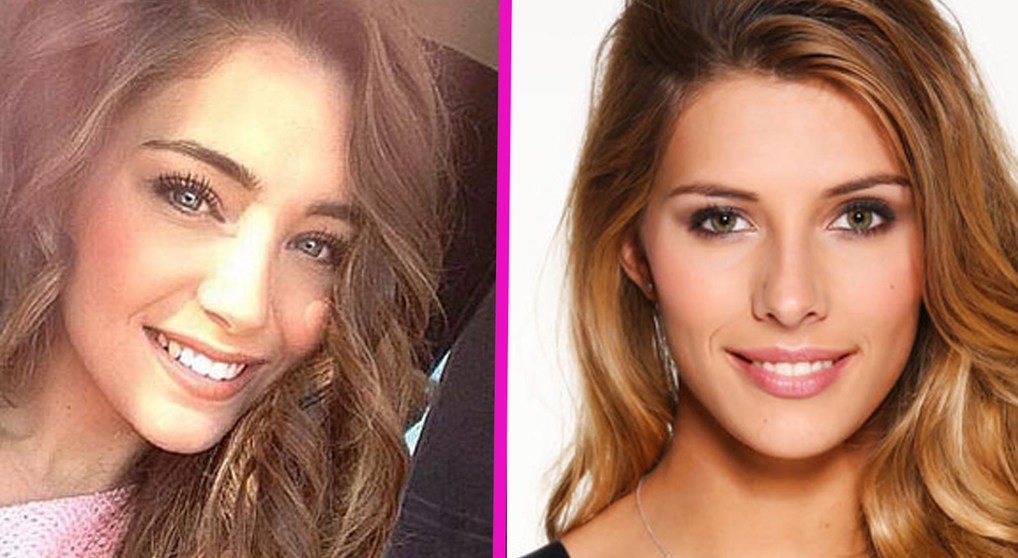 Miss France 2015 a refusé de se refaire le nez