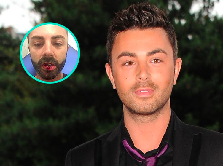 #QVEMF : Benjamin s'exprime suite à son accident