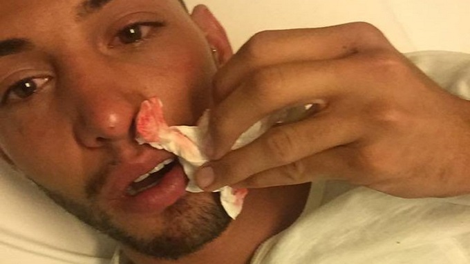 #SS8 : Sacha, agressé et défiguré en sortant de boîte car il est gay
