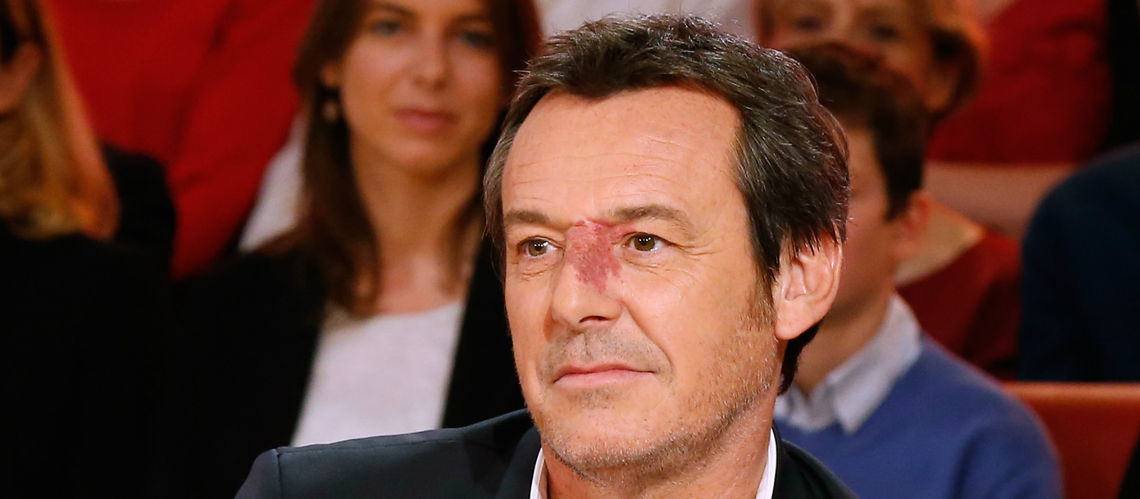 Jean-Luc Reichmann enfonce Tex suite à sa mauvaise blague sur les violences conjugales