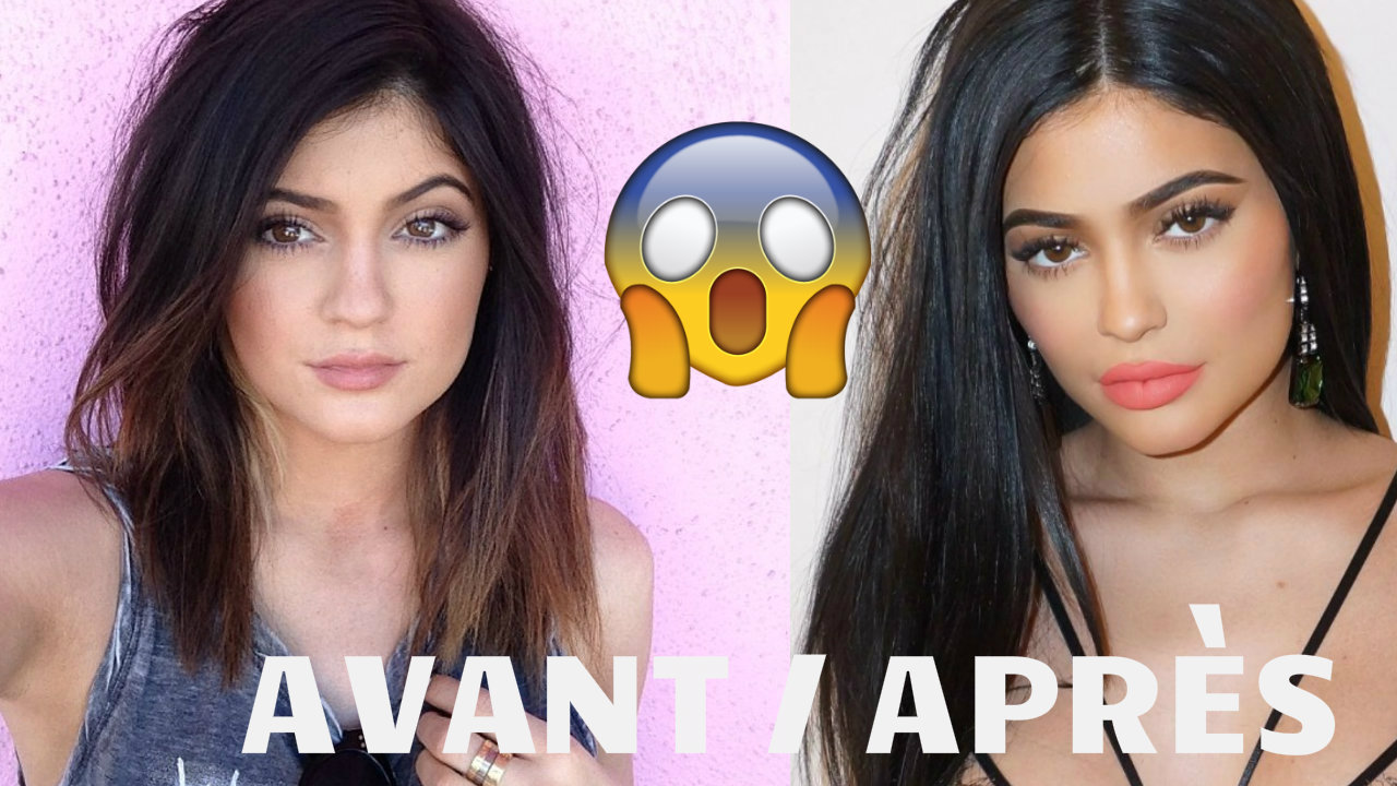 Avant / Après : Kylie Jenner, son incroyable transformation physique