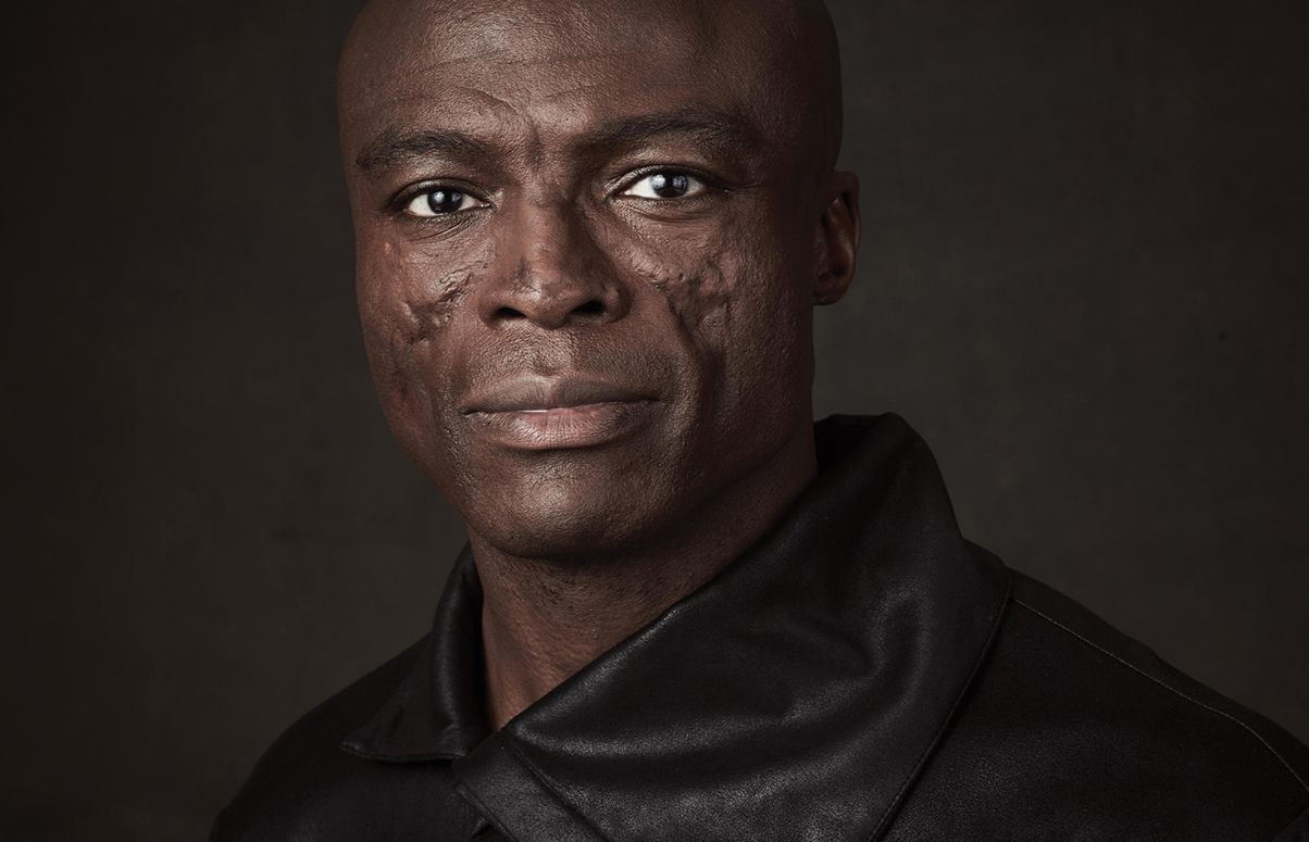 Seal : La véritable nature de ses cicatrices au visage