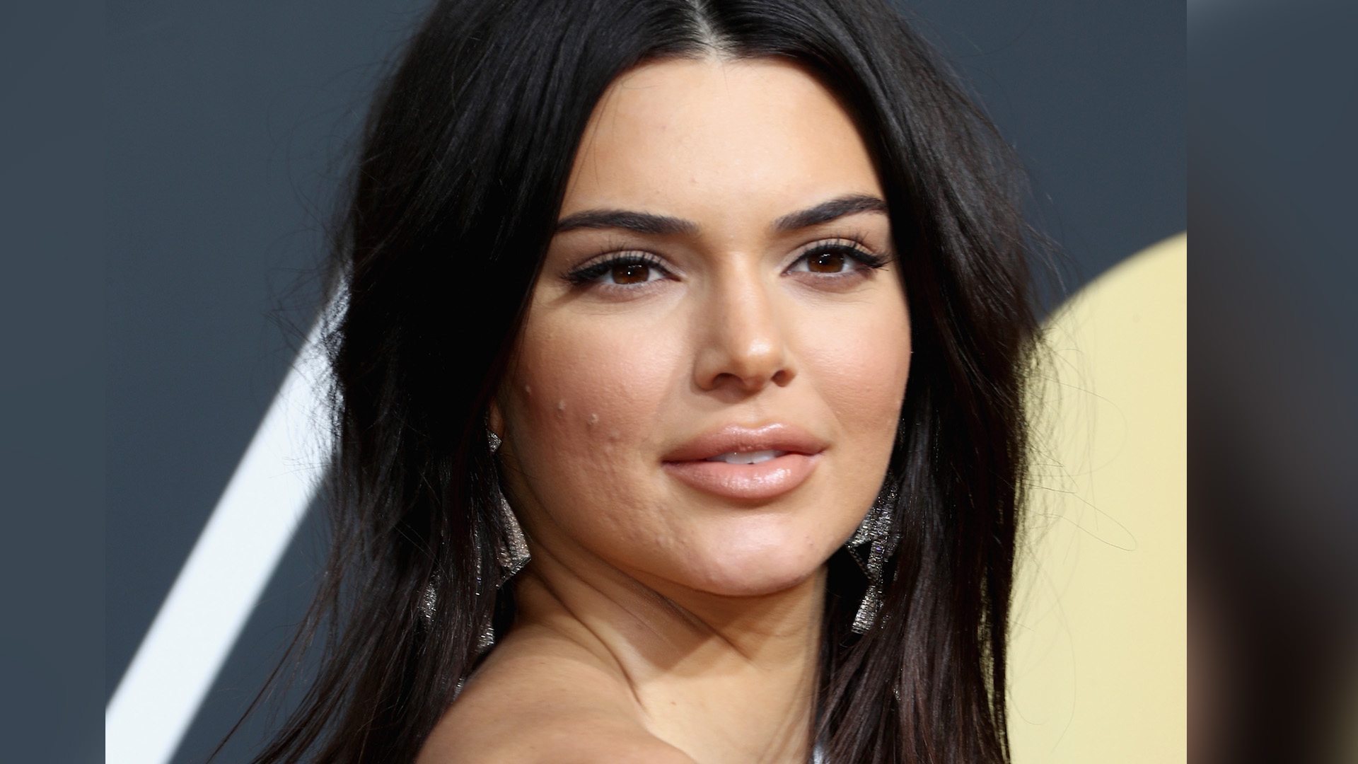 Kendall Jenner moquée pour son acné, elle répond aux haters !