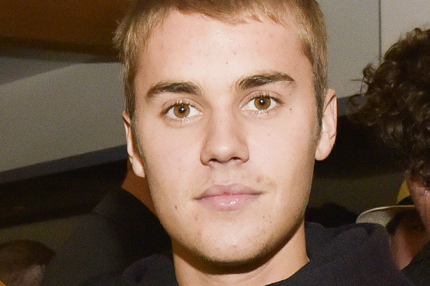 Justin Bieber déclare l’acné tendance !