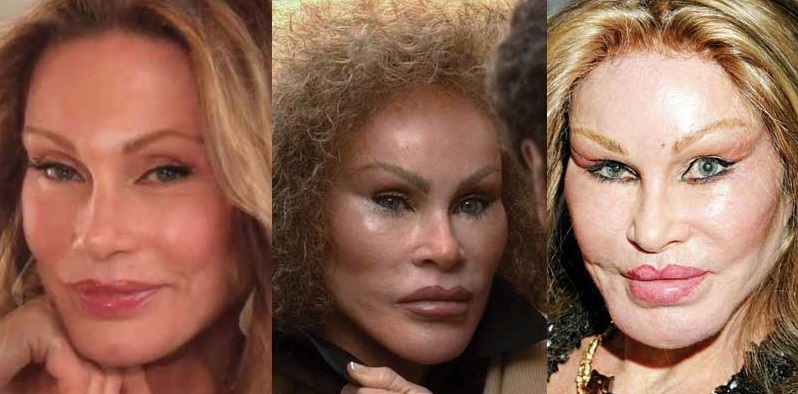 Jocelyn Wildenstein : La femme chat est ruinée