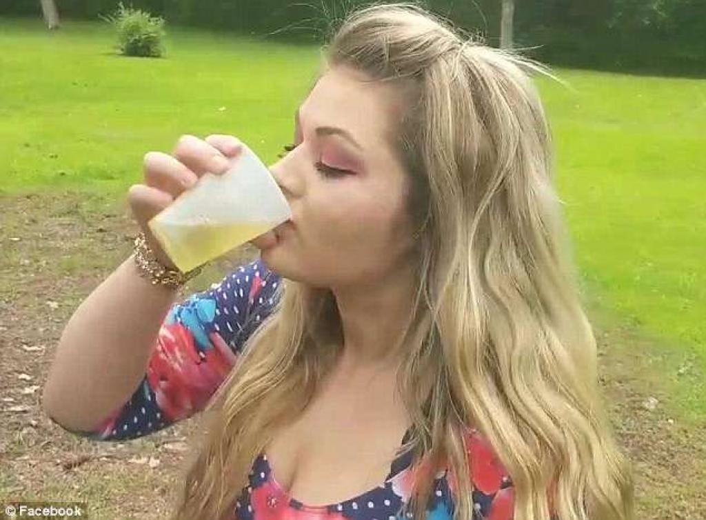 Comme remède  contre l'acné, cette jeune femme boit... l'urine de son chien !