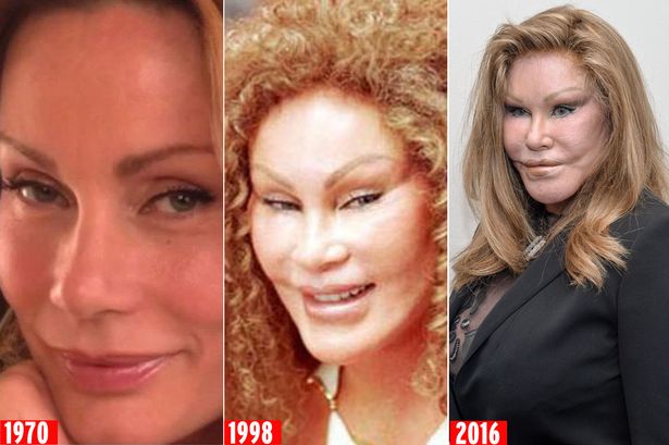 Jocelyn Wildenstein  : Ruinée, la femme chat se paye le luxe de perdre 250.000 $ de bijoux