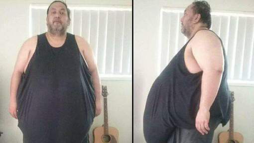 Cet homme souffrait d'obésité morbide jusqu'à révéler son secret