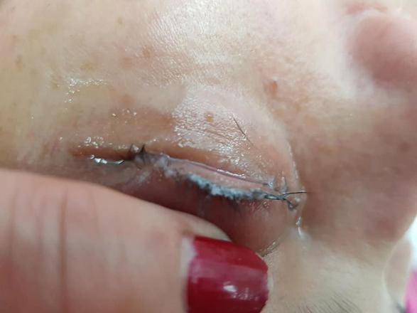 Son esthéticienne lui pose des faux cils avec de la super glue : le résultat est terrible