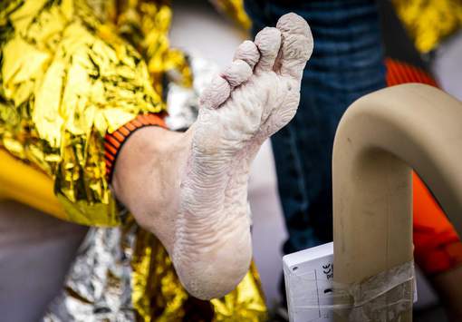 L'incroyable état de ce nageur après avoir passé 55 heures dans l'eau