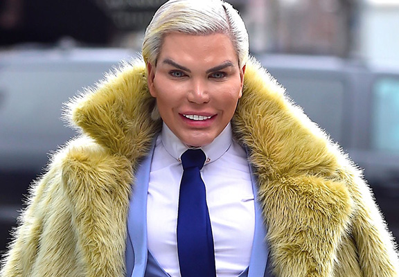 Rodrigo Alves (Ken humain) : Son nouveau lifting des fesses ultra douloureux