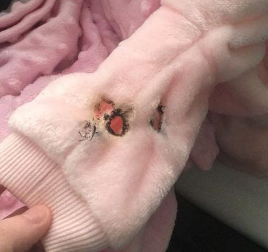 Grande-Bretagne : Un homme jette sa cigarette dans une poussette et brûle le bébé à l’intérieur