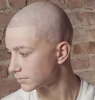 Royaume-Uni : Chauve à 16 ans, un adolescent se fait tatouer des cheveux