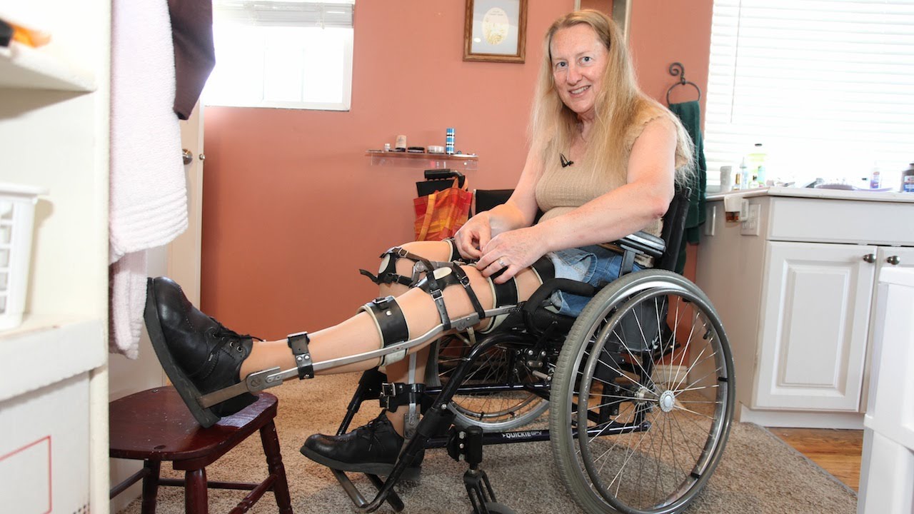 Cette femme veut être opérée pour devenir... handicapée