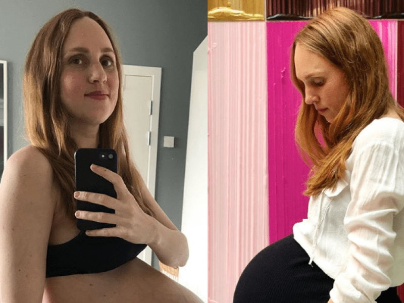 Enceinte de triplés, elle partage les photos de son ventre après l'accouchement