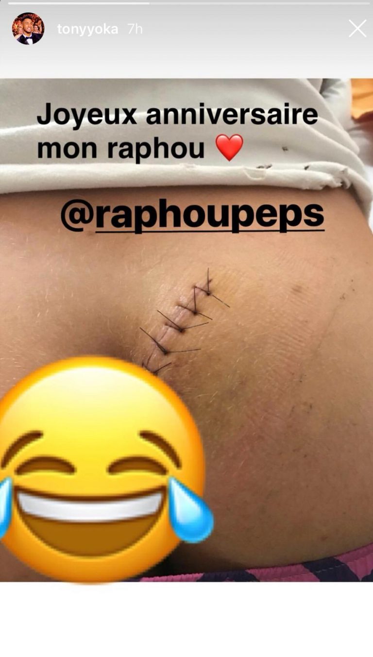 Raphaël Pépin (Les Vacances des Anges 3) : sa blessure à la fesse dévoilée !