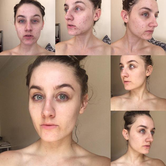 Une femme cesse de se laver le visage pendant 6 mois et publie une photo avant/après