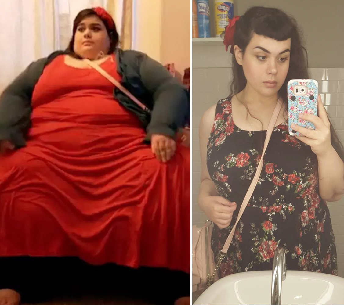 Avant/après : Amber pesait 300 kilos, désormais, elle est méconnaissable