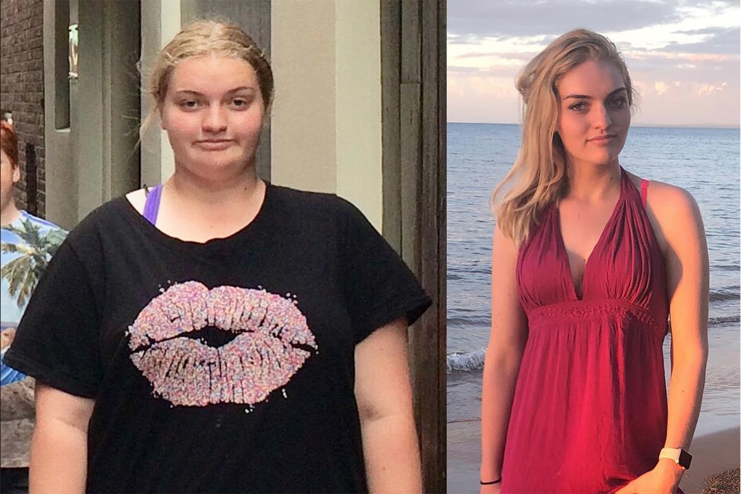 Australie : Longtemps en surpoids, une jeune femme décide de perdre 60 kilos et devient influenceuse