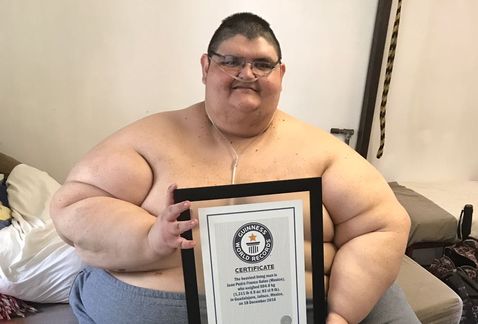 Ancien homme le plus gros au monde, il a déjà perdu 300 kilos [photo]