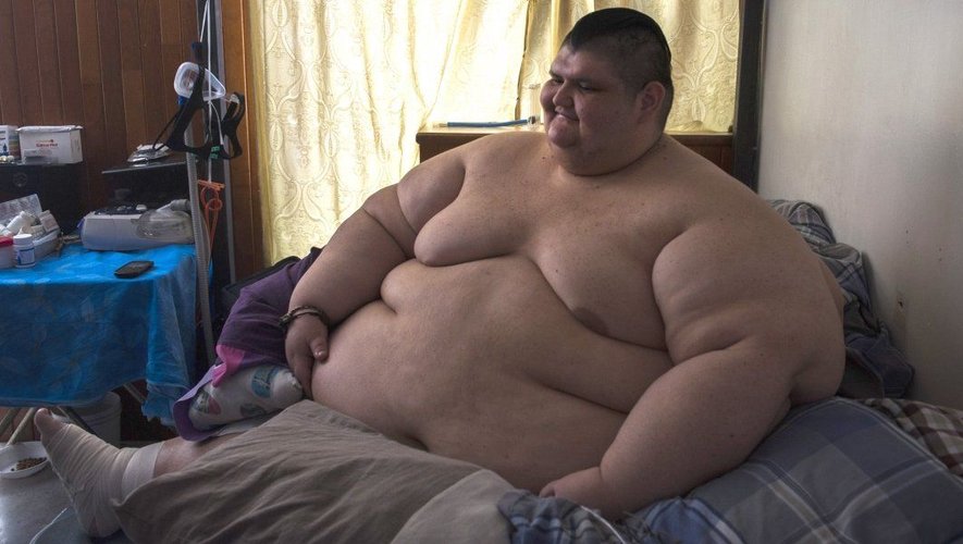 Ancien homme le plus gros au monde, il a déjà perdu 300 kilos [photo]