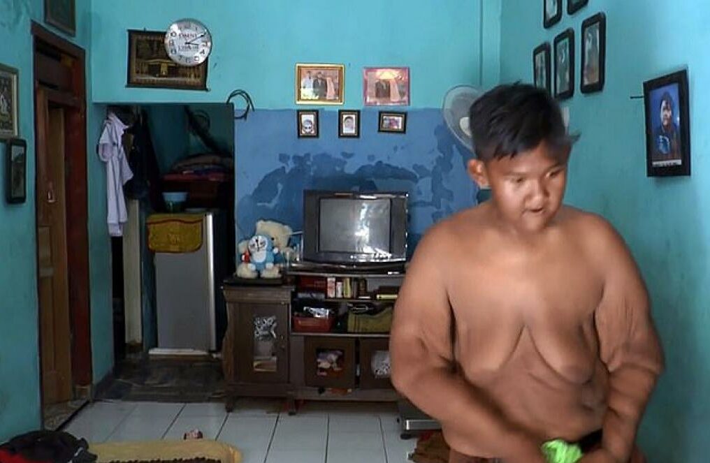 L'incroyable métamorphose d'un enfant qui pesait 190 kilos