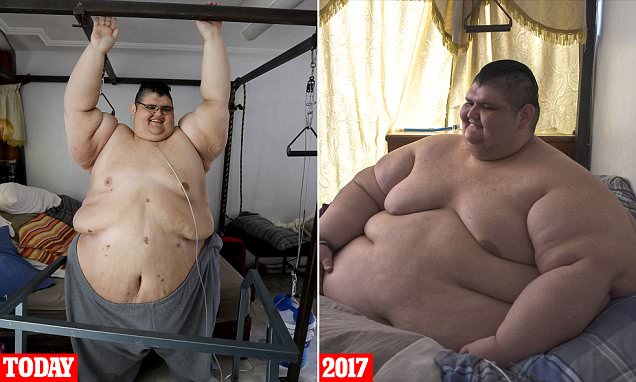 Ancien homme le plus gros au monde, il a déjà perdu 300 kilos [photo]