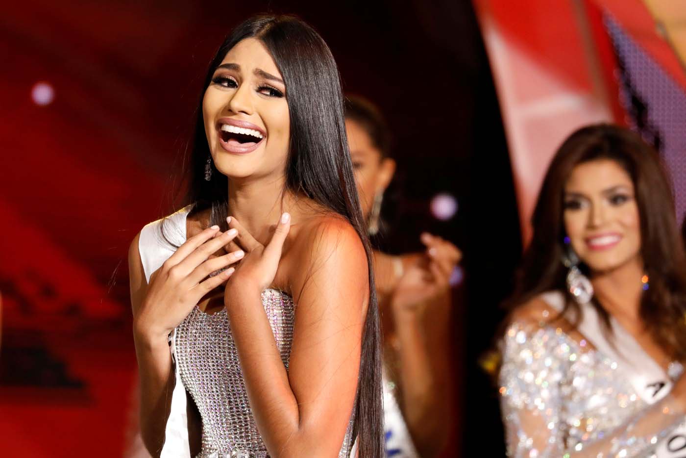 Avant et après chirurgie : Les photos de Miss Venezuela qui choquent les internautes