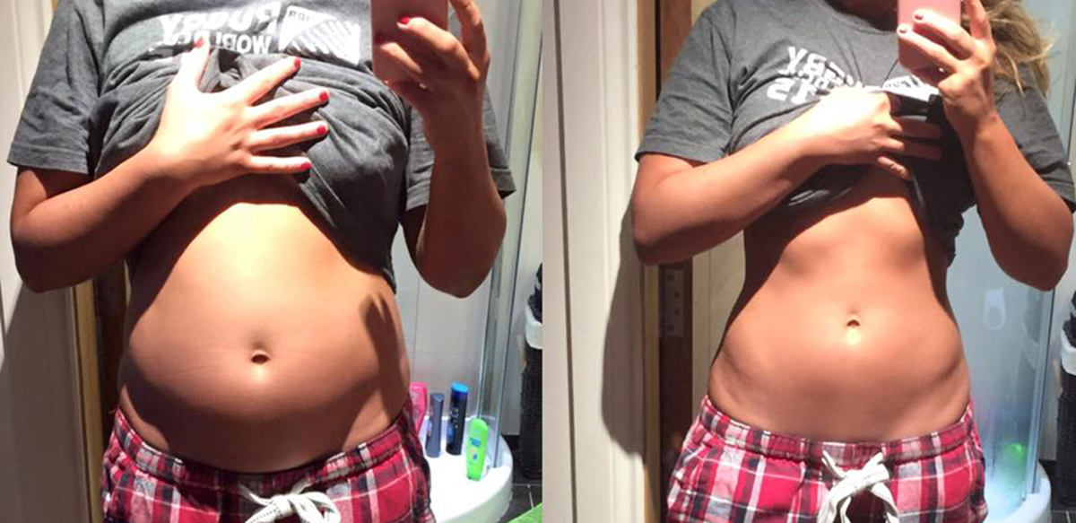 Foodbaby : Baby bump ou ballonnements ? Le nouveau buzz sur le net !