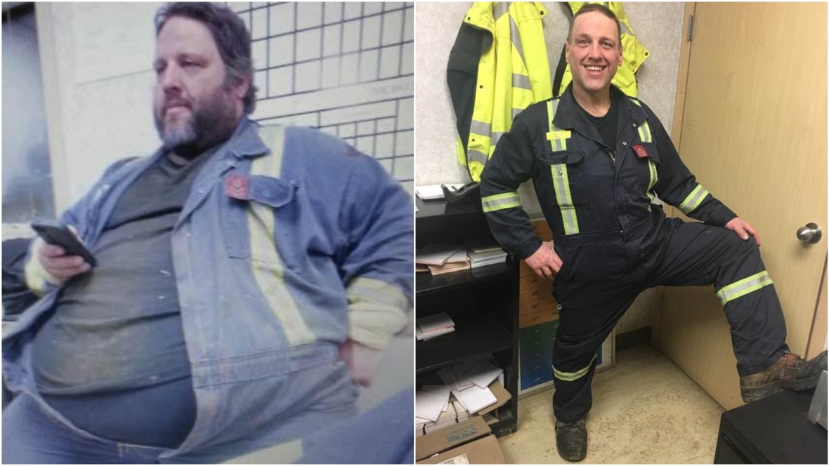 Avant/après : Un Canadien perd 150 kilos après l’incendie de Fort McMurray