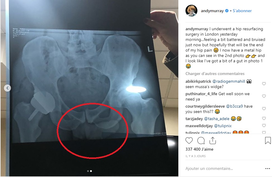 Andy Murray dévoile... son pénis par erreur sur une radiographie !