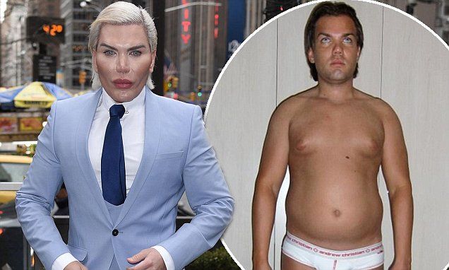 Rodrigo Alves : Son menton explose, les médecins refusent de l’opérer