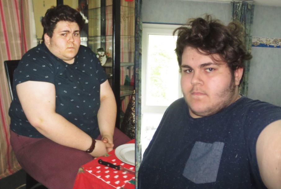 Avant/après : Après avoir perdu 84 kilos, un jeune homme explique son mal-être