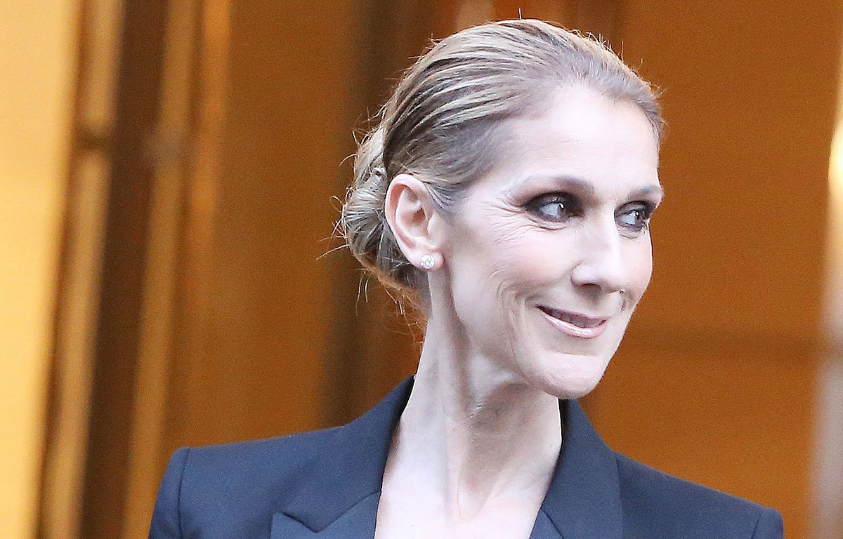 Céline Dion envisage à nouveau avoir recours à la chirurgie esthétique