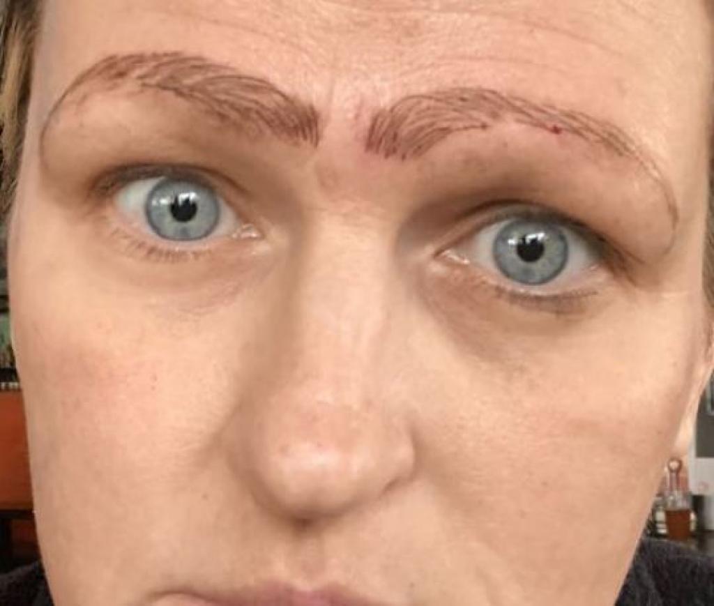 Microblading : Elle se retrouve avec 4 sourcils tatoués sur le visage