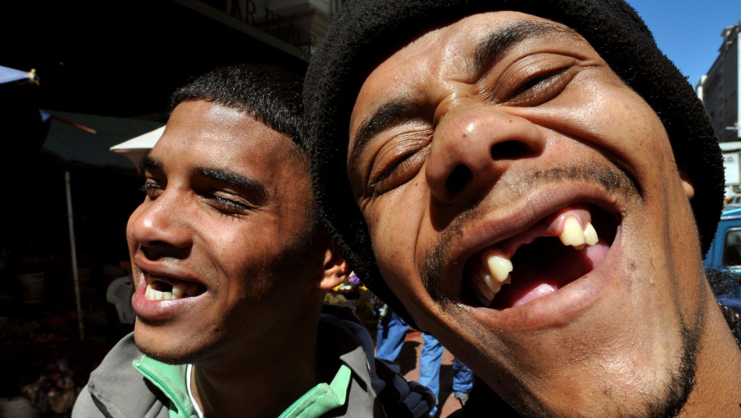 Afrique du Sud : les habitants se font arracher les dents pour... être plus beaux
