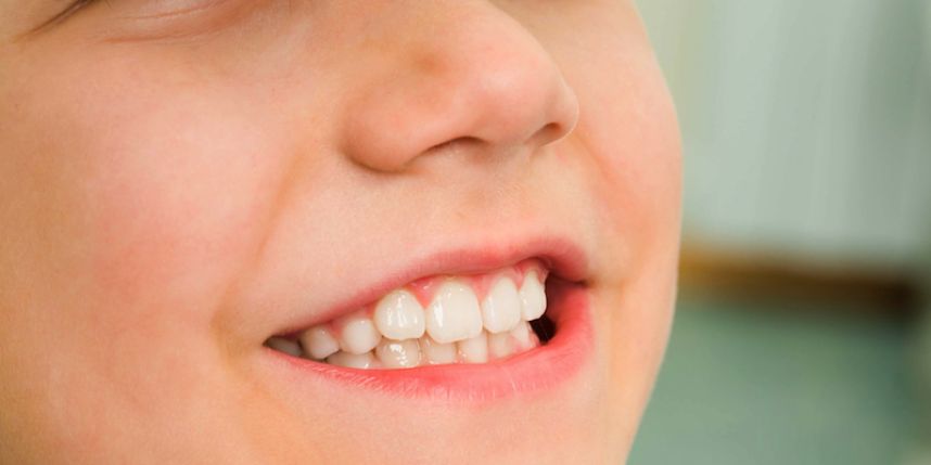 Les dents de cet enfant sont ravagées à cause d’une boisson bien connue