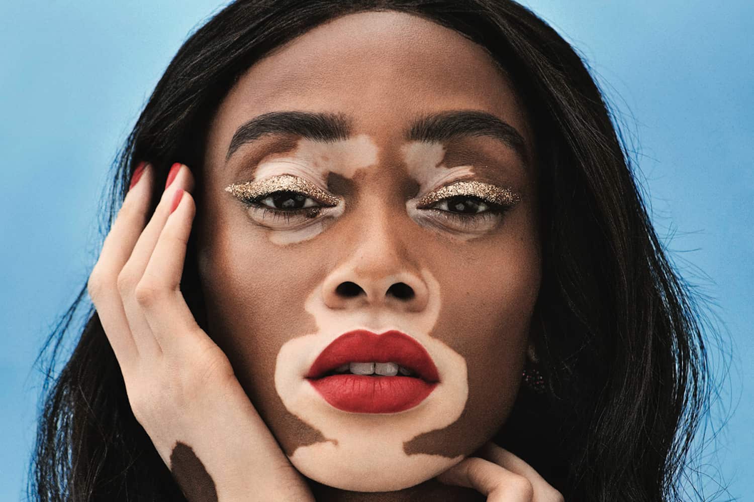 Winnie Harlow : La mannequin atteinte de vitiligo revient sur sa maladie