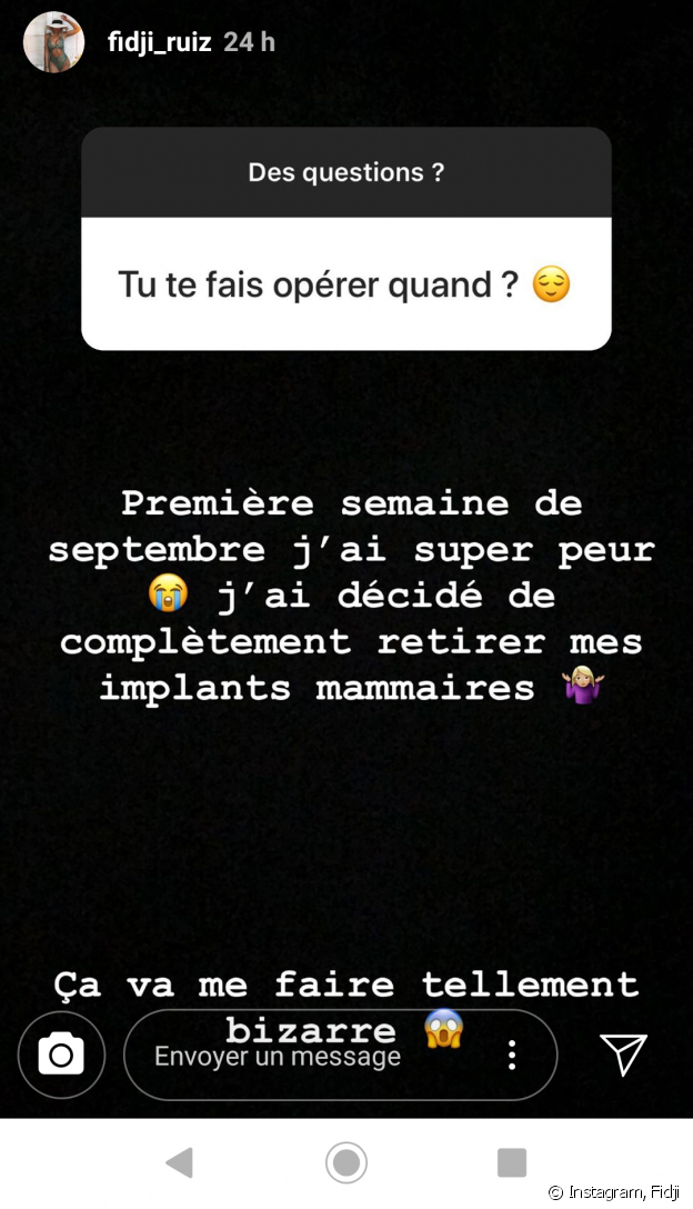 Fidji Ruiz en dit plus sur sa prochaine chirurgie esthétique