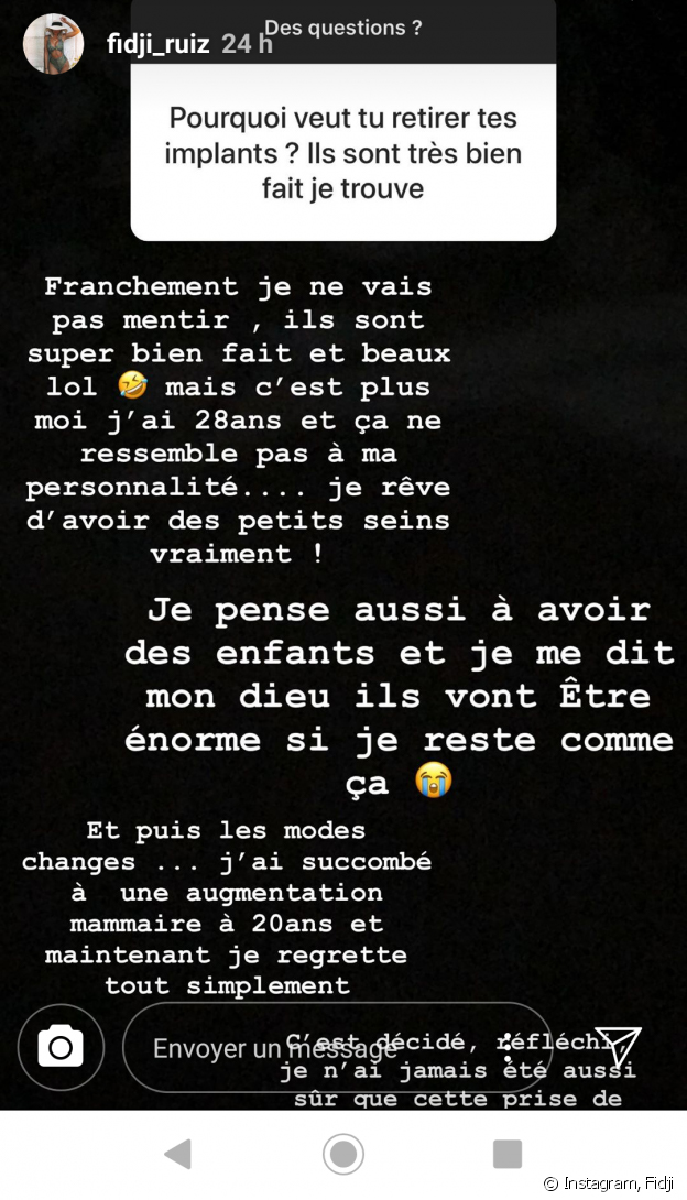 Fidji Ruiz en dit plus sur sa prochaine chirurgie esthétique