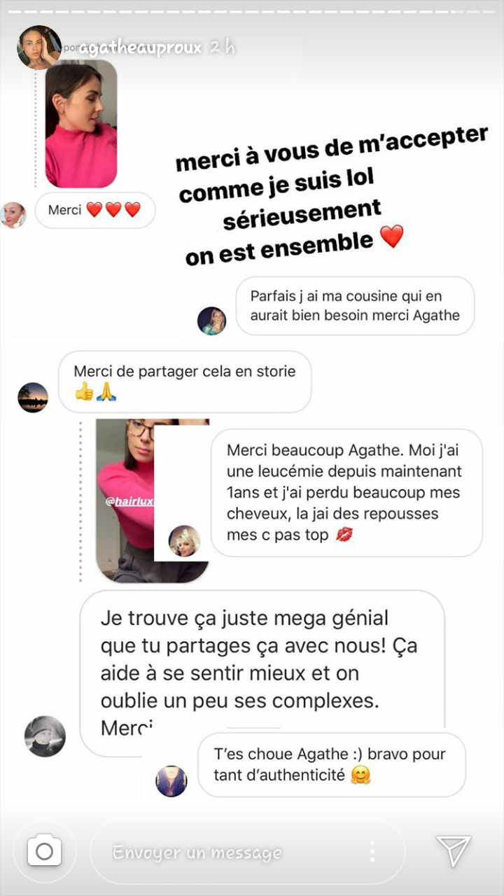 Agathe Auproux guérie du cancer : Elle dévoile son secret pour de beaux cheveux