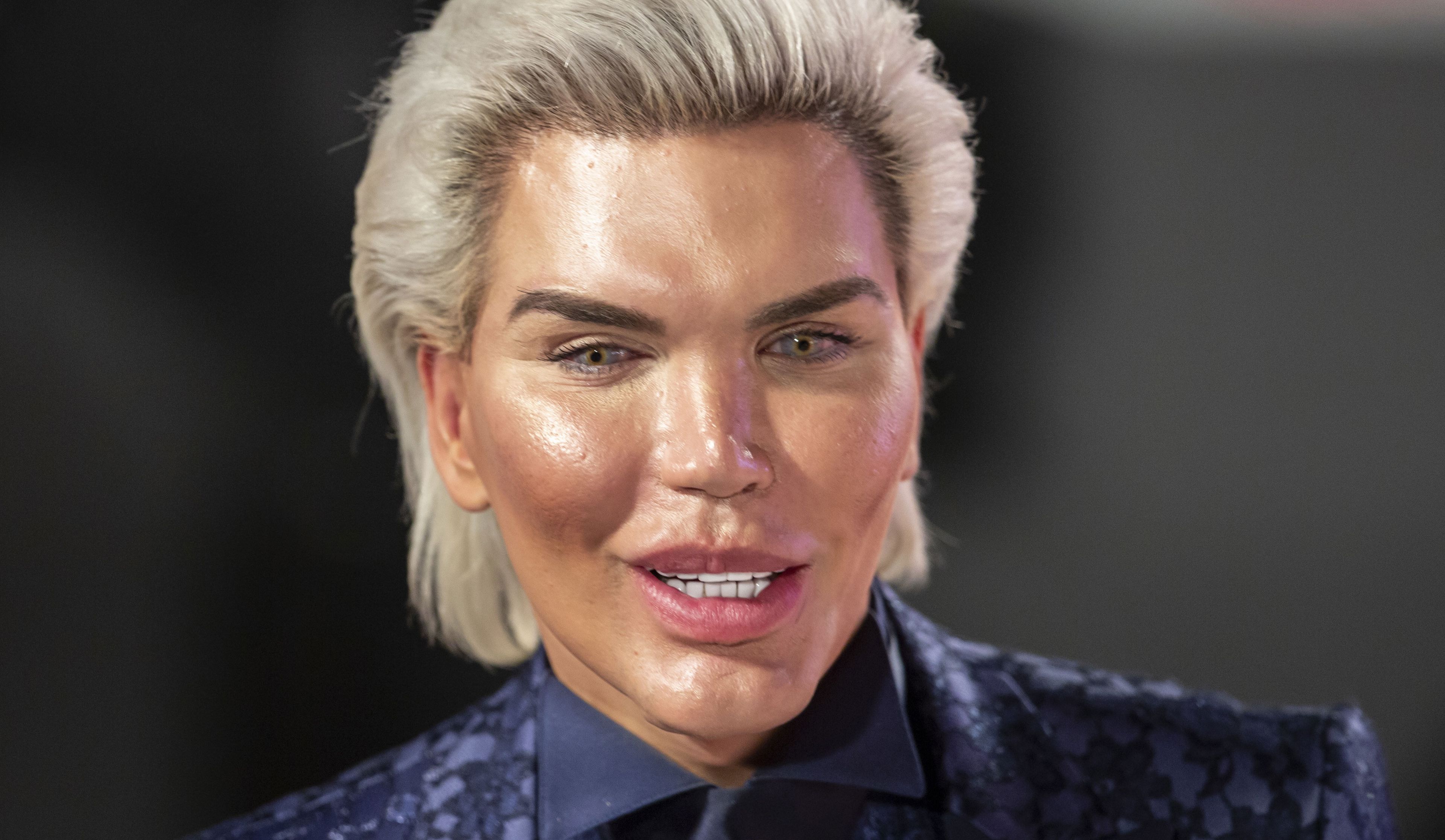 Rodrigo Alves : Le Ken humain a (encore) été opéré