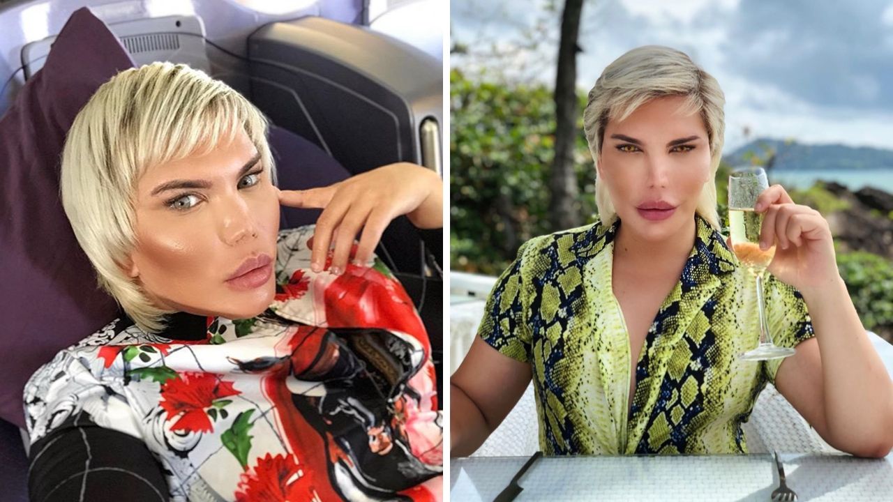 Rodrigo Alves : Le nez du Ken Humain commence à tomber...