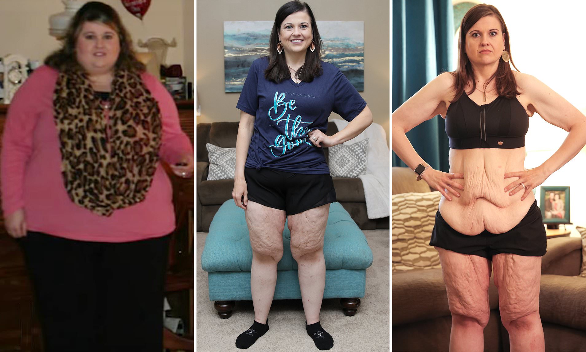 Transformation physique : Elle arrête la malbouffe et perd 120 kilos