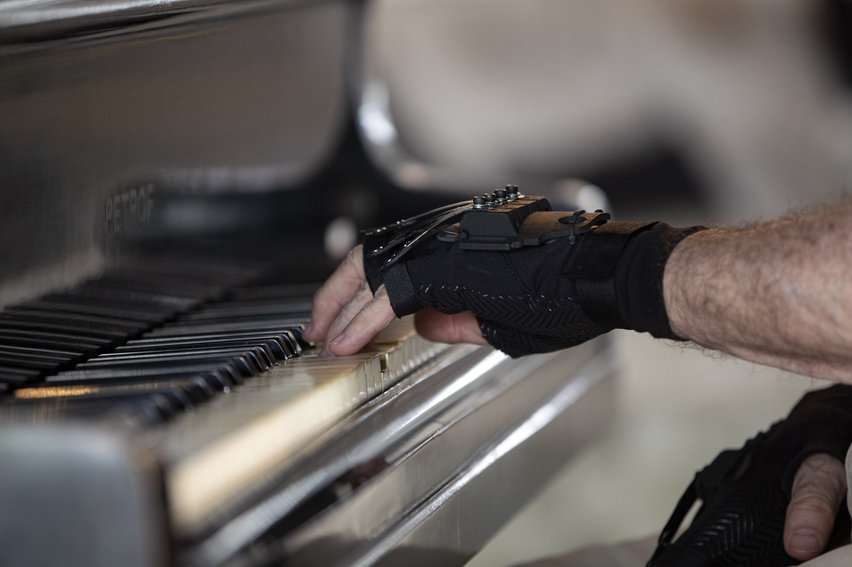 Ce génie du piano peut jouer à nouveau grâce à des mains bioniques