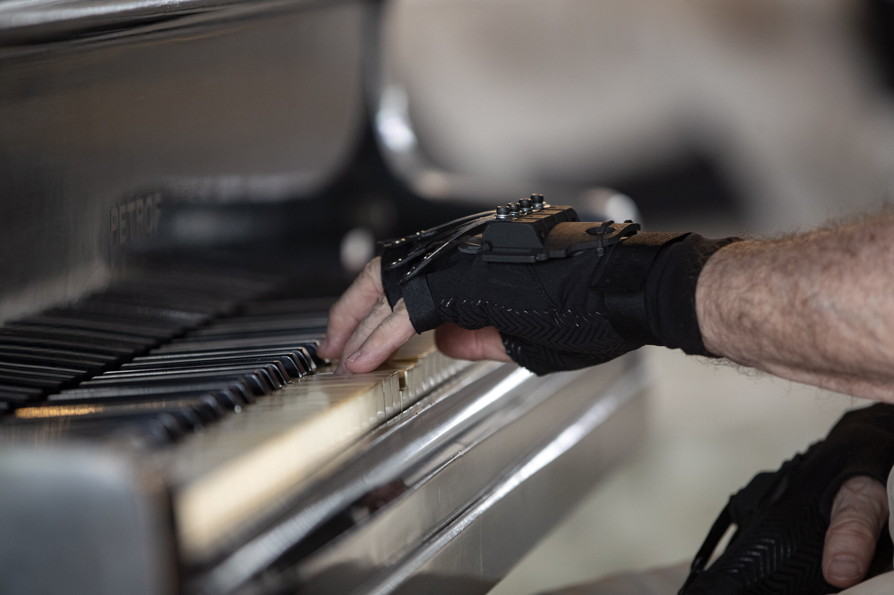 Ce génie du piano peut jouer à nouveau grâce à des mains bioniques