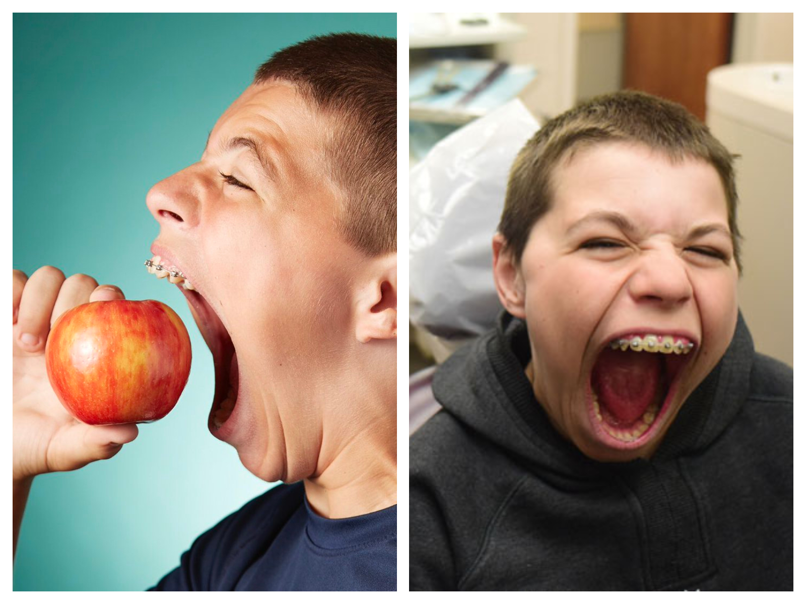 Ce jeune garçon de 14 ans possède... la plus grande bouche au monde !