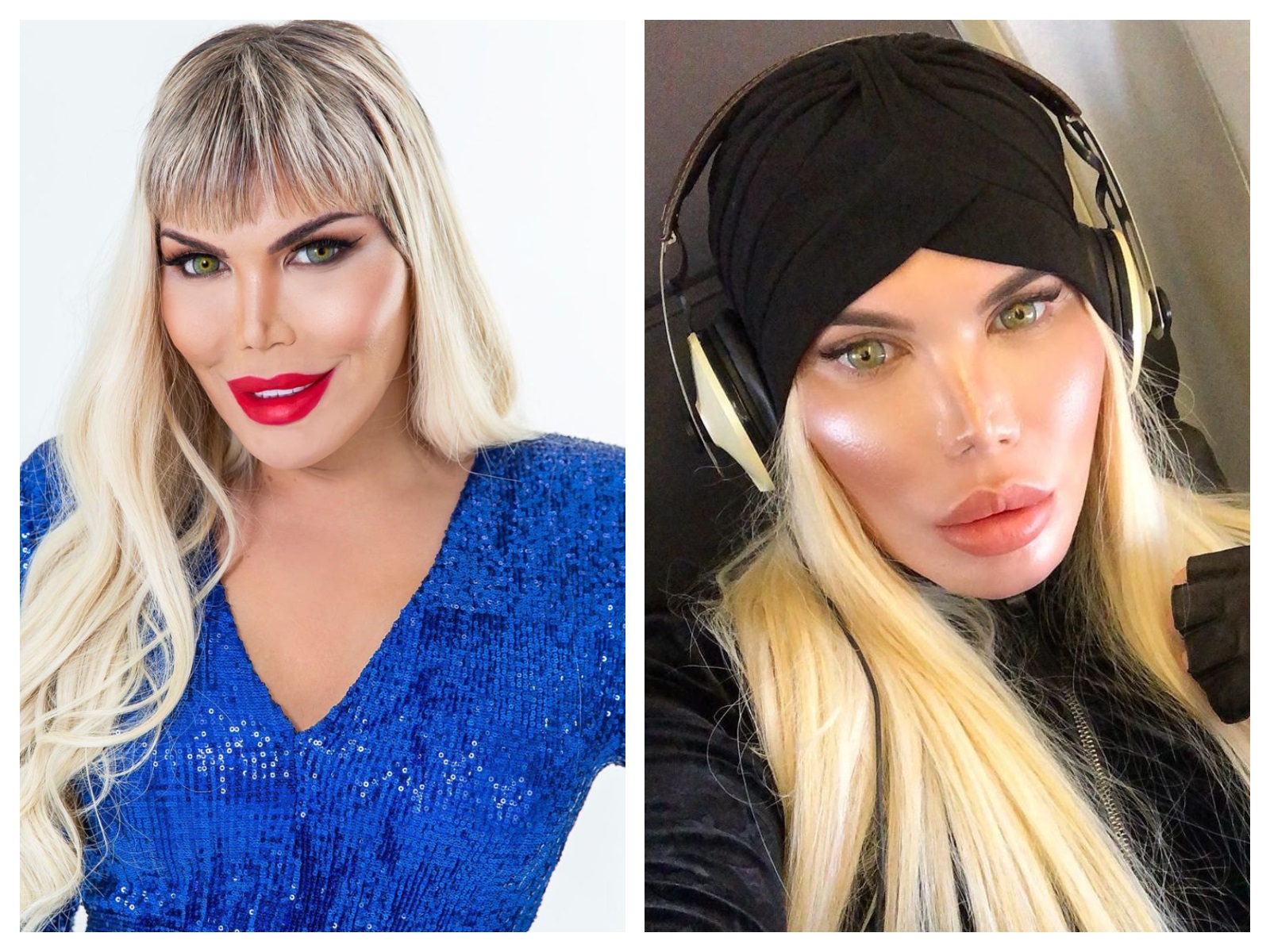 Rodrigo Alves, le Ken Humain est désormais... une femme !